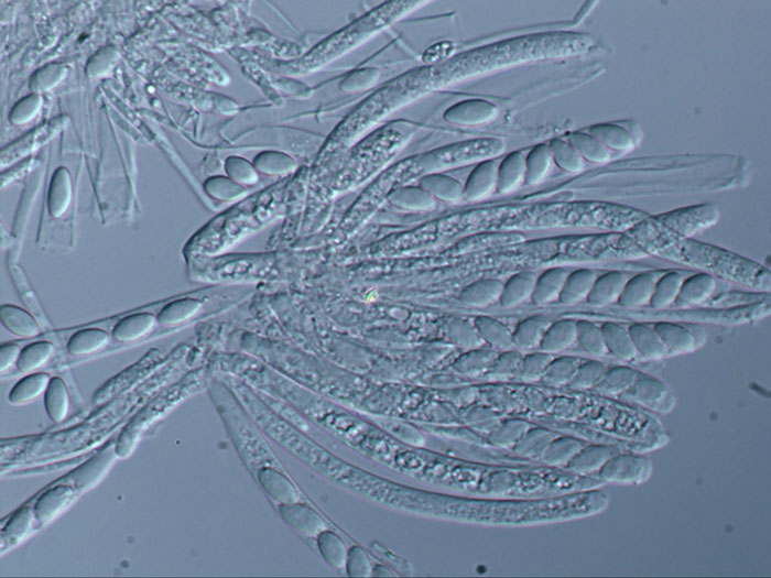 Ciborinia hirtella