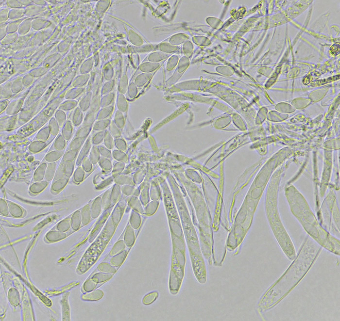 Cyathicula amenti