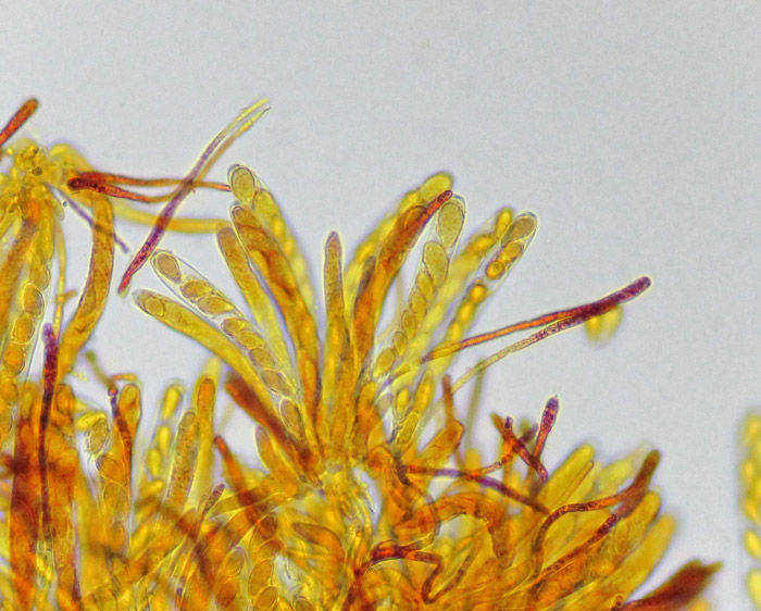 Cyathicula amenti