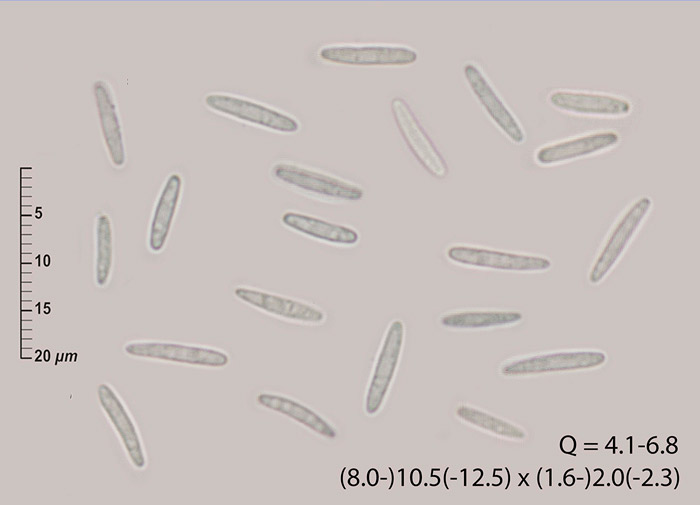 Dasyscyphella crystallina