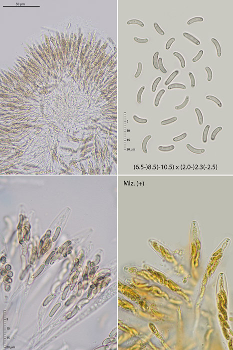 Diatrype stigma