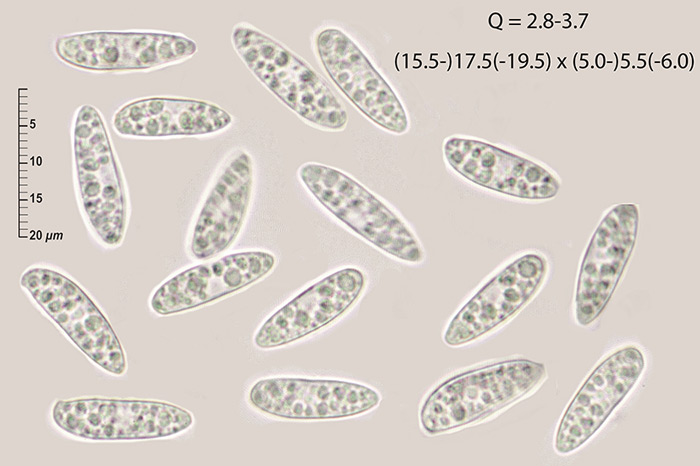 Hymenoscyphus calyculus