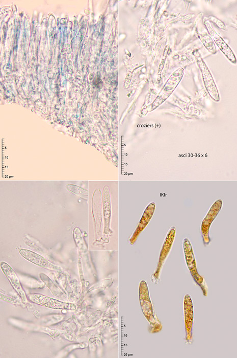 Hyphodiscus otanii