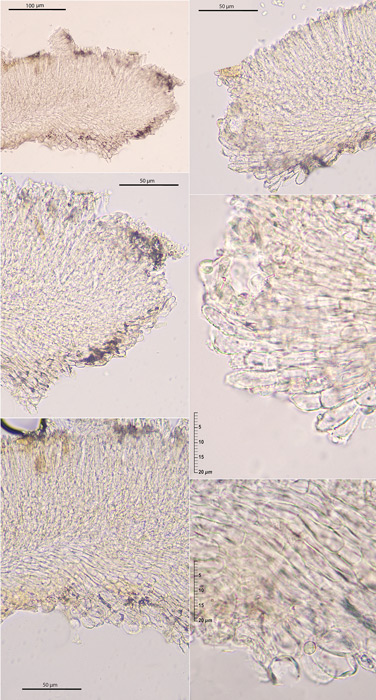 Hyphodiscus otanii