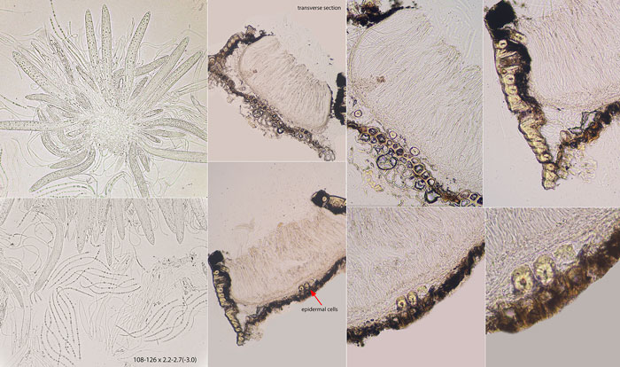 Lophodermium conigenum