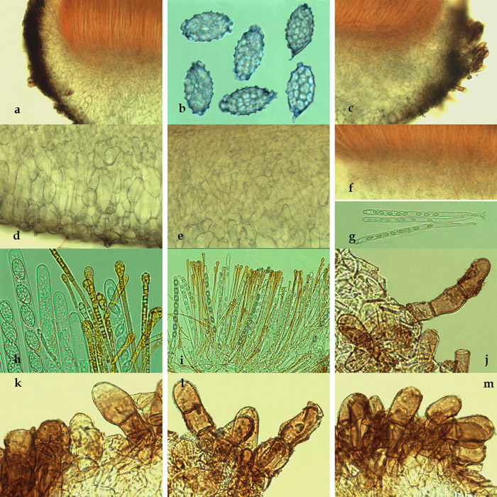 Melastiza cornubiensis