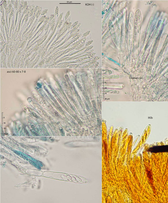 Mollisia benesuada