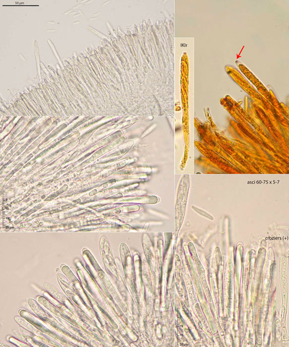 Mollisia lothariana