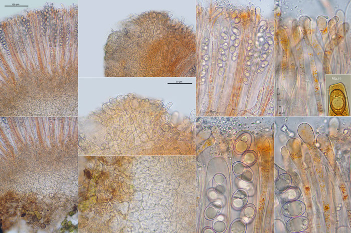 Octospora humosa