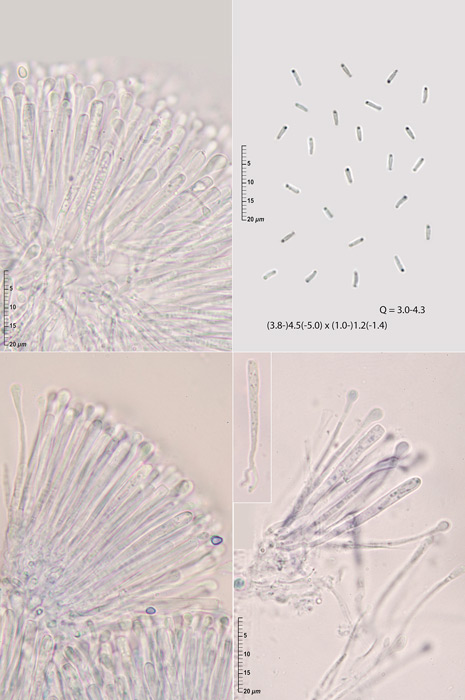 Orbilia dryadum