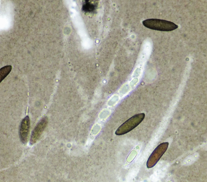 Rosellinia marcucciana