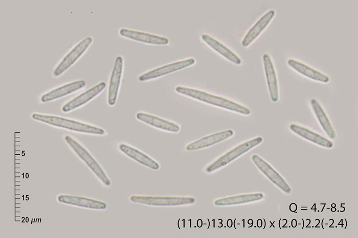 Trichopeziza mollissima