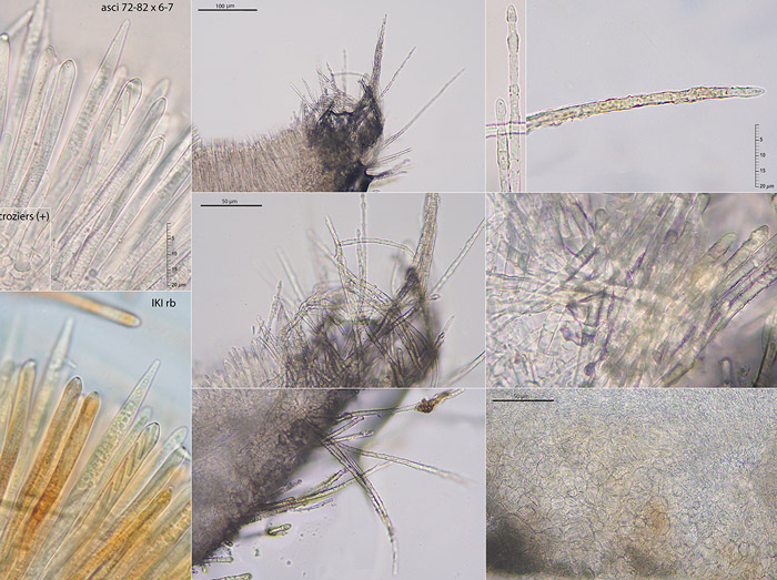 Trichopeziza mollissima