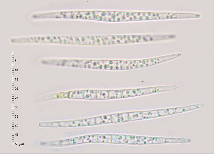 Tubeufia cerea