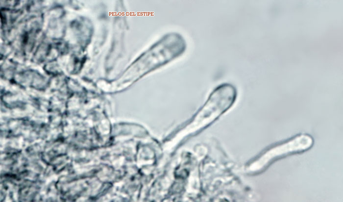 Arrhenia chlorocyanea