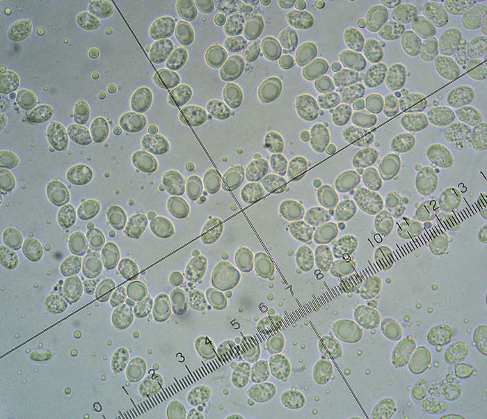 Hyphodermella corrugata