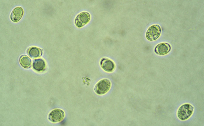 Pseudolaccaria pachyphylla